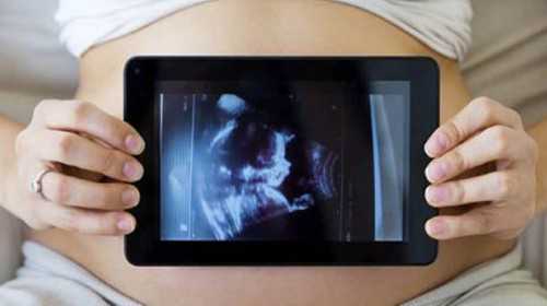 上海孕妇怀上八胞胎后医生建议减胎的原因你知道吗？