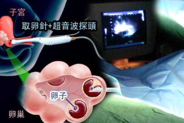 上海高价找助孕婴店,上海三大助孕公司费用坤和优惠吗,上海私立的助孕公司做