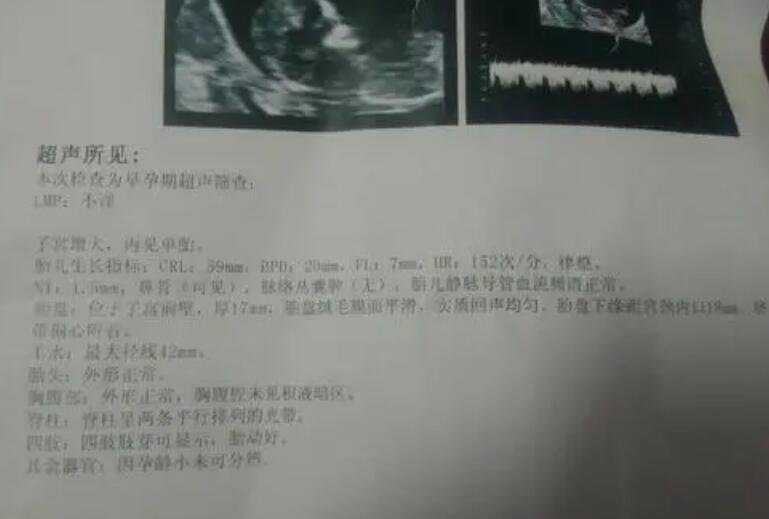 想找个上海代孕的女人 上海第三代试管婴儿移植后要注意什么? ‘孕妇彩超下男