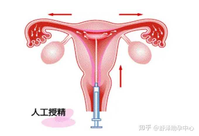 上海妇产科排名前十的医院,上海哪些医院可以做试管婴儿？?